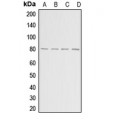 LifeSab™ ADAR2 Rabbit pAb (50 µl)