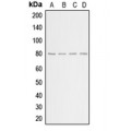 LifeSab™ GRK2 Rabbit pAb (50 µl)