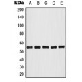 LifeSab™ AKT (pT308) Rabbit pAb (50 µl)