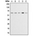 LifeSab™ AKT (pY315) Rabbit pAb (50 µl)