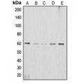 LifeSab™ AKT2 Rabbit pAb (50 µl)