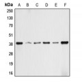 LifeSab™ ALDOA Rabbit pAb (50 µl)