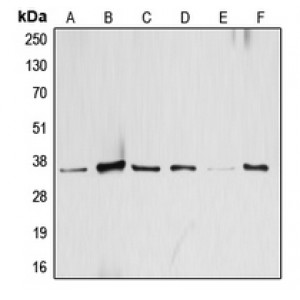LifeSab™ ATF1 Rabbit pAb (50 µl)