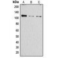 LifeSab™ SERCA1 Rabbit pAb (50 µl)