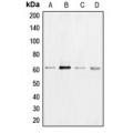 LifeSab™ B-RAF Rabbit pAb (50 µl)