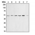 LifeSab™ Cyclin E1 Rabbit pAb (50 µl)