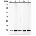 LifeSab™ p15 INK4b Rabbit pAb (50 µl)