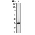 LifeSab™ C/EBP delta/epsilon Rabbit pAb (50 µl)