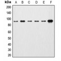 LifeSab™ Beta-catenin Rabbit pAb (50 µl)