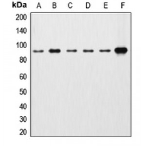 LifeSab™ Beta-catenin Rabbit pAb (50 µl)