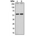 LifeSab™ Cytochrome P450 26A1 Rabbit pAb (50 µl)