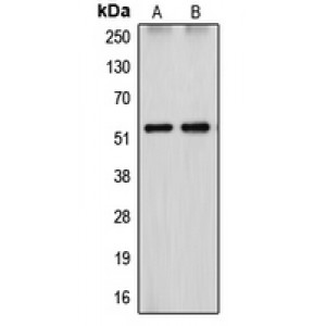 LifeSab™ Cytochrome P450 26A1 Rabbit pAb (50 µl)