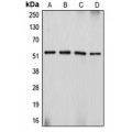 LifeSab™ Desmin Rabbit pAb (50 µl)