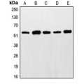 LifeSab™ ETS1 (pT38) Rabbit pAb (50 µl)