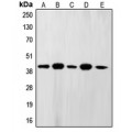 LifeSab™ FEN1 Rabbit pAb (50 µl)