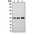 LifeSab™ FYN (pY530) Rabbit pAb (50 µl)