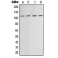 LifeSab™ mGLUR5 Rabbit pAb (50 µl)