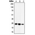 LifeSab™ HADH2 Rabbit pAb (50 µl)