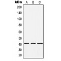 LifeSab™ HCCS Rabbit pAb (50 µl)
