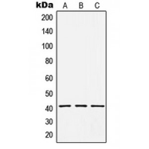 LifeSab™ HCCS Rabbit pAb (50 µl)