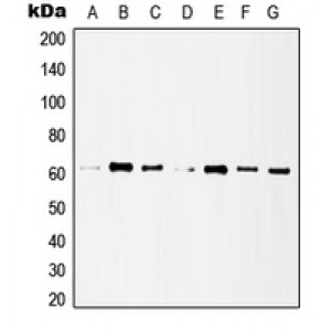 LifeSab™ Histone Deacetylase 1 Rabbit pAb (50 µl)