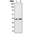 LifeSab™ HOXA1 Rabbit pAb (50 µl)
