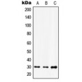 LifeSab™ HOXD12 Rabbit pAb (50 µl)