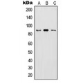 LifeSab™ IKK beta (pY199) Rabbit pAb (50 µl)