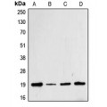 LifeSab™ Cofilin (pS3) Rabbit pAb (50 µl)