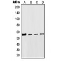 LifeSab™ Cytokeratin 8 Rabbit pAb (50 µl)