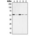 LifeSab™ Cytokeratin 10 Rabbit pAb (50 µl)