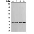 LifeSab™ Cytokeratin 17 Rabbit pAb (50 µl)