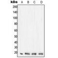 LifeSab™ STMN1 Rabbit pAb (50 µl)