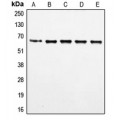 LifeSab™ FOXO4 (pS197) Rabbit pAb (50 µl)