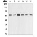 LifeSab™ MMP1 Rabbit pAb (50 µl)