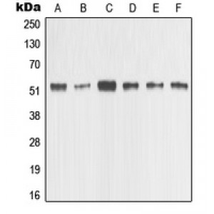 LifeSab™ MMP1 Rabbit pAb (50 µl)