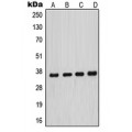 LifeSab™ MNAT1 Rabbit pAb (50 µl)