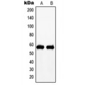 LifeSab™ c-Myc (pT58) Rabbit pAb (50 µl)