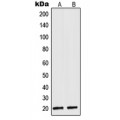 LifeSab™ NDUFA8 Rabbit pAb (50 µl)