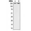 LifeSab™ NF1 Rabbit pAb (50 µl)