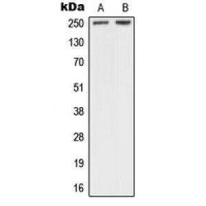 LifeSab™ NF1 Rabbit pAb (50 µl)