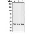 LifeSab™ PKA C alpha/beta/gamma Rabbit pAb (50 µl)