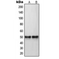 LifeSab™ RAR beta Rabbit pAb (50 µl)