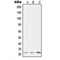 LifeSab™ RPL17 Rabbit pAb (50 µl)