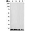 LifeSab™ RPL30 Rabbit pAb (50 µl)