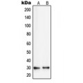 LifeSab™ RPS8 Rabbit pAb (50 µl)