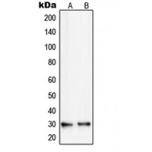 LifeSab™ RPS8 Rabbit pAb (50 µl)