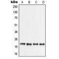 LifeSab™ RPS9 Rabbit pAb (50 µl)