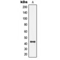 LifeSab™ MKK4 (pT261) Rabbit pAb (50 µl)