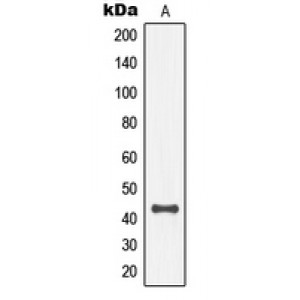 LifeSab™ MKK4 (pT261) Rabbit pAb (50 µl)